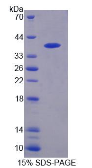 Recombinant Protein Tyrosine Phosphatase, Non Receptor Type 9 (PTPN9)