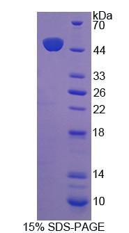 Recombinant Protein Tyrosine Phosphatase, Non Receptor Type 14 (PTPN14)