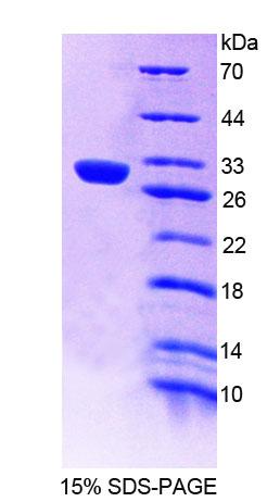 Recombinant Protein Tyrosine Phosphatase, Non Receptor Type 14 (PTPN14)