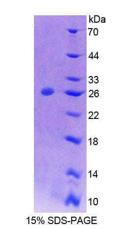 Recombinant Protein Tyrosine Phosphatase, Non Receptor Type 21 (PTPN21)