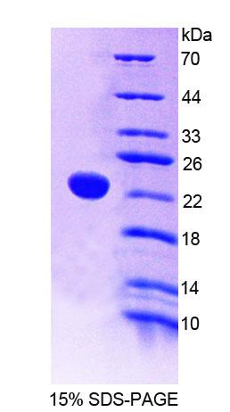 Recombinant Protein Tyrosine Phosphatase Receptor Type E (PTPRE)