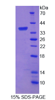 Recombinant Protein Tyrosine Phosphatase Receptor Type G (PTPRG)