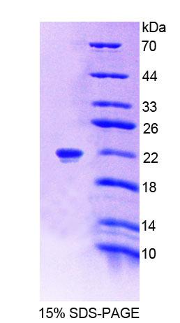 Recombinant Protein Tyrosine Phosphatase Receptor Type Z (PTPRZ)