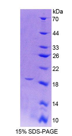 Recombinant Protein Tyrosine Phosphatase Receptor Type Z (PTPRZ)