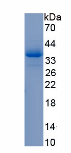 Recombinant Protein Tyrosine Phosphatase F Interacting Protein 1 (PPFIA1)