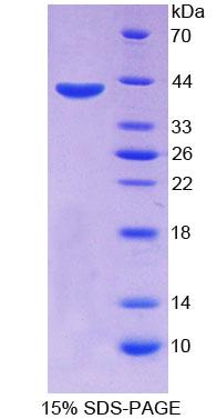 Recombinant ATP Binding Cassette Transporter A4 (ABCA4)