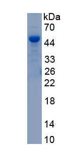 Recombinant ATP Binding Cassette Transporter A4 (ABCA4)