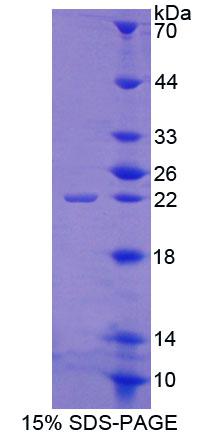 Recombinant ATP Binding Cassette Transporter E1 (ABCE1)