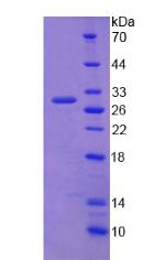 Recombinant ATP Binding Cassette Transporter C2 (ABCC2)