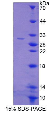 Recombinant ATP Binding Cassette Transporter C6 (ABCC6)