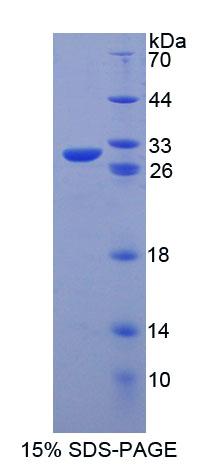 Recombinant ATP Binding Cassette Transporter B4 (ABCB4)