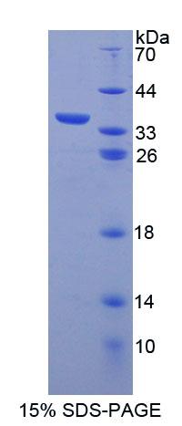 Recombinant ATP Binding Cassette Transporter B7 (ABCB7)