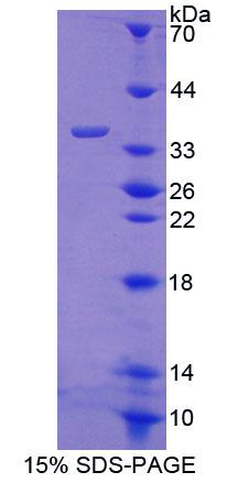 Recombinant ATP Binding Cassette Transporter B7 (ABCB7)