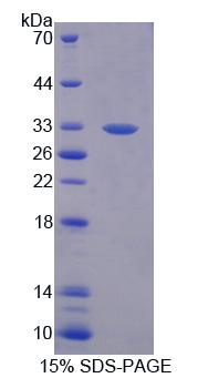 Recombinant ATP Binding Cassette Transporter B8 (ABCB8)