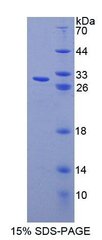 Recombinant ATP Binding Cassette Transporter F1 (ABCF1)