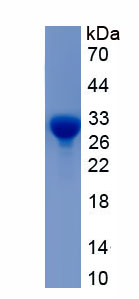 Recombinant ATP Binding Cassette Transporter D3 (ABCD3)