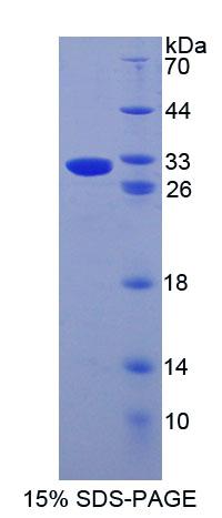 Recombinant ATP Binding Cassette Transporter D4 (ABCD4)