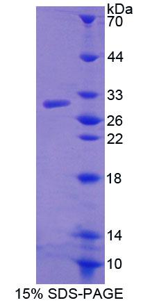 Recombinant ATP Binding Cassette Transporter D4 (ABCD4)