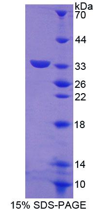 Recombinant ATP Binding Cassette Transporter G8 (ABCG8)