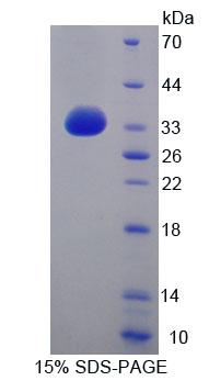 Recombinant ATP Binding Cassette Transporter G8 (ABCG8)