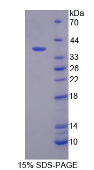 Recombinant Regulator Of G Protein Signaling 9 (RGS9)