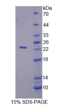 Recombinant Regulator Of G Protein Signaling 10 (RGS10)