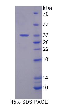 Recombinant Regulator Of G Protein Signaling 3 (RGS3)