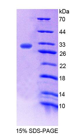 Recombinant Runt Related Transcription Factor 3 (RUNX3)