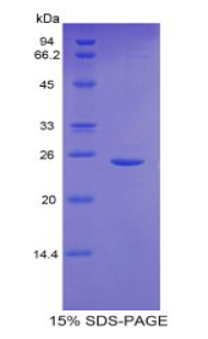 Recombinant Glutamate Cysteine Ligase, Catalytic (GCLC)