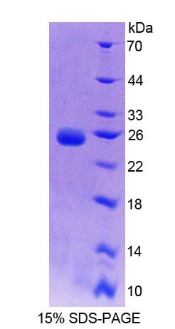 Recombinant Branched Chain Aminotransferase 2, Mitochondrial (BCAT2)