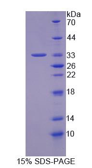 Recombinant Dipeptidyl Peptidase 3 (DPP3)