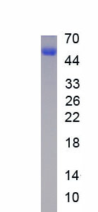 Recombinant General Transcription Factor IIIA (GTF3A)