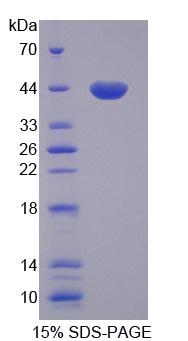 Recombinant General Transcription Factor IIIA (GTF3A)