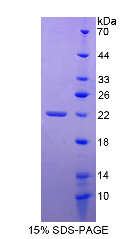 Recombinant Tumor Necrosis Factor Receptor Superfamily, Member 14 (TNFRSF14)