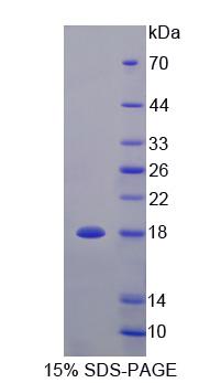 Recombinant Tumor Necrosis Factor Receptor Superfamily, Member 25 (TNFRSF25)