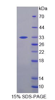 Recombinant Proteasome Assembly Chaperone 2 (PSMG2)