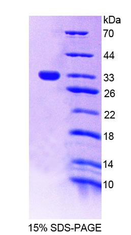 Recombinant Proteasome Assembly Chaperone 2 (PSMG2)