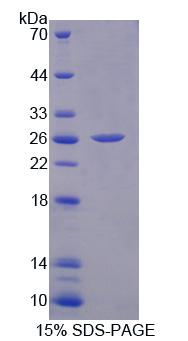 Recombinant Liver Receptor Homolog 1 (LRH1)