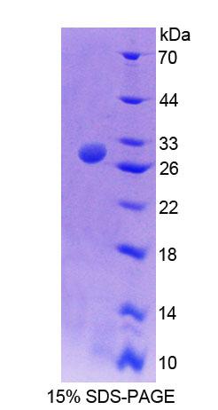 Recombinant Transcription Elongation Factor A2 (TCEA2)