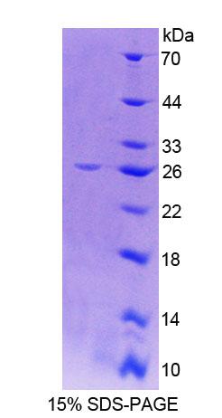 Recombinant Cathepsin O (CTSO)