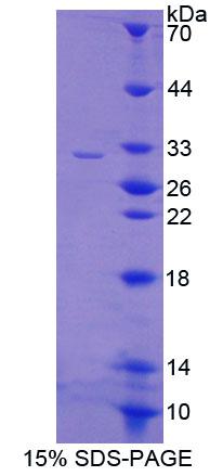 Recombinant Cyclic AMP Response Element Binding Protein 5 (CREB5)