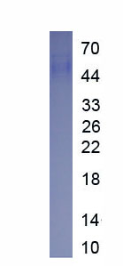 Recombinant CREB Regulated Transcription Coactivator 2 (CRTC2)