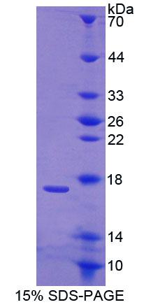 Recombinant Calcium Binding Protein 1 (CABP1)