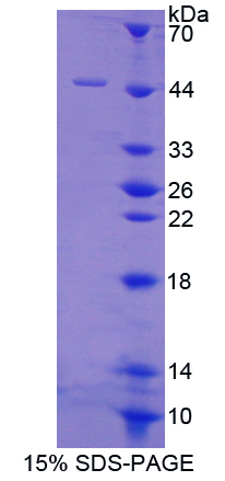 RPE020Hu01.jpg