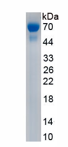 RPE117Hu02.jpg