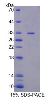 RPE122Hu01.jpg