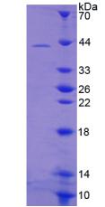 RPE136Hu01.jpg