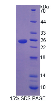 RPE140Hu01.jpg