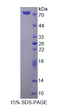 RPE162Hu01.jpg