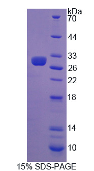 RPE171Hu01.jpg